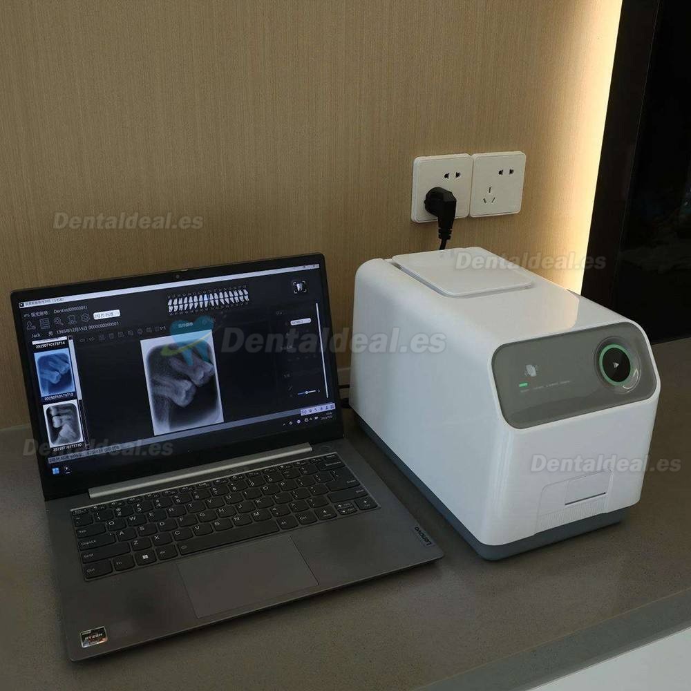 Handy IPS3 Esc&aacute;ner PSP Dental de Radiograf&iacute;a Digital M&aacute;quina de Escaneo de Imagen